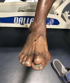 男明星露脚趾,揭秘男明星脚趾下的时尚魅力